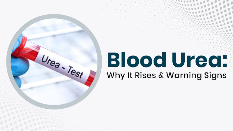 Blood Urea: Why It Rises & Warning Signs Service